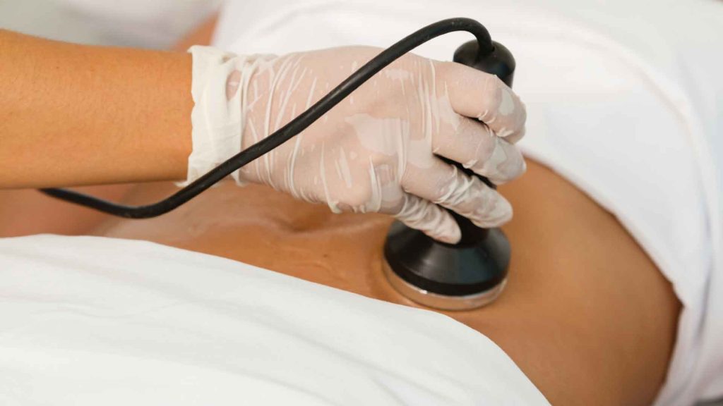 اپراتئر در حال استفاده از دستگاه لاغری روی بدن بیمار برای لاغری شکم و پهلو